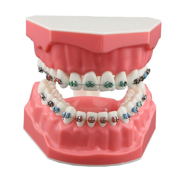 Ortho Tooth Model