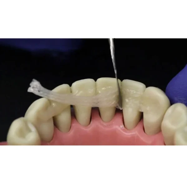 Kids-e-Dental E-Splint - Image 3