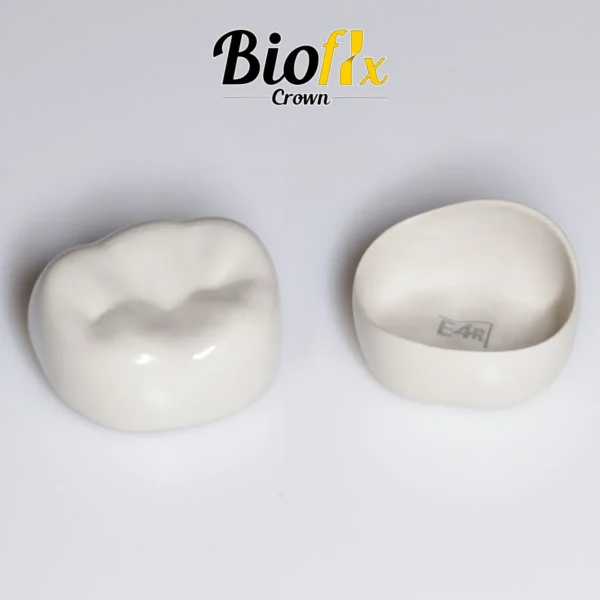 Kids E-Dental Bioflx Posterior Crown Master Kit of 56 pcs - Image 5